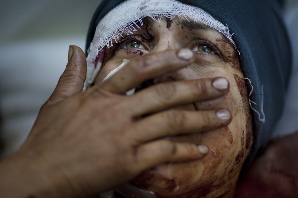 Una mujer, Aida, es seriamente herida luego que el ejército sirio bombardeara su casa en Idlib, al norte del país en marzo de 2012. Su marido y dos niños fueron asesinados y tres de sus hijas, Hada, 10, Eva, 13 y Hana, 12, gravemente heridas.  La fotografía recibió el primer premio en su categoría en el World Press Photo 2013 e integra la cobertura sobre el conflicto armado en Siria realizada por el equipo de reporteros gráficos de la agencia Associated Press que recibió el premio Pullitzer 2013.