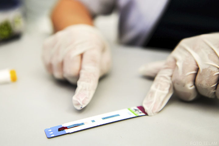 En la Argentina también se prueba una vacuna contra el VIH